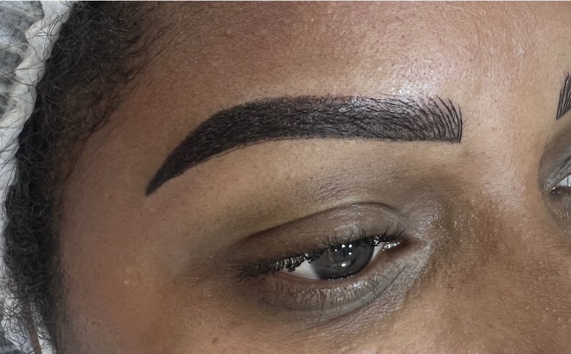 Centro Estético Rosane Aragão | Estética Guarujá | Bioestimulador de Colágeno | Microagulhamento | Limpeza de Pele